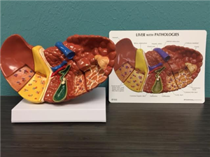 The Liver 